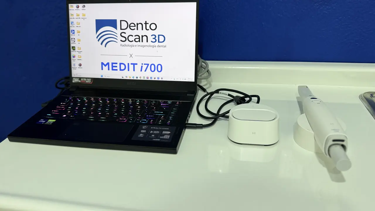 Escáner intraoral Medit i700 junto a la computadora de escaneo